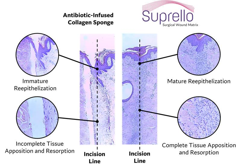 A diagram showing a wound model.